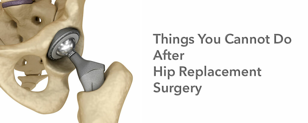 Facts About Joint Injuries Hip Replacement Surgery In Pakistan Prof